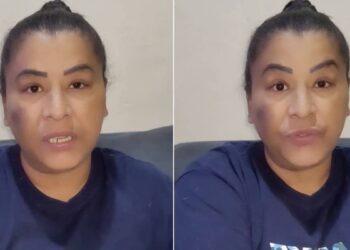 Internada, MC Katia passa por nova amputação: “Foi necessário”