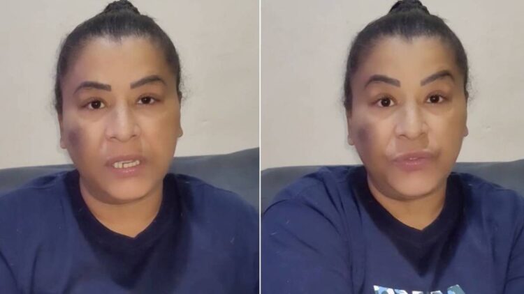 Internada, MC Katia passa por nova amputação: “Foi necessário”