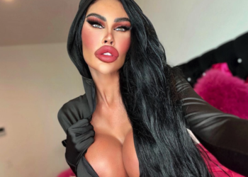 Percebeu a diferença? Barbie Humana reduz preenchimento labial; veja fotos